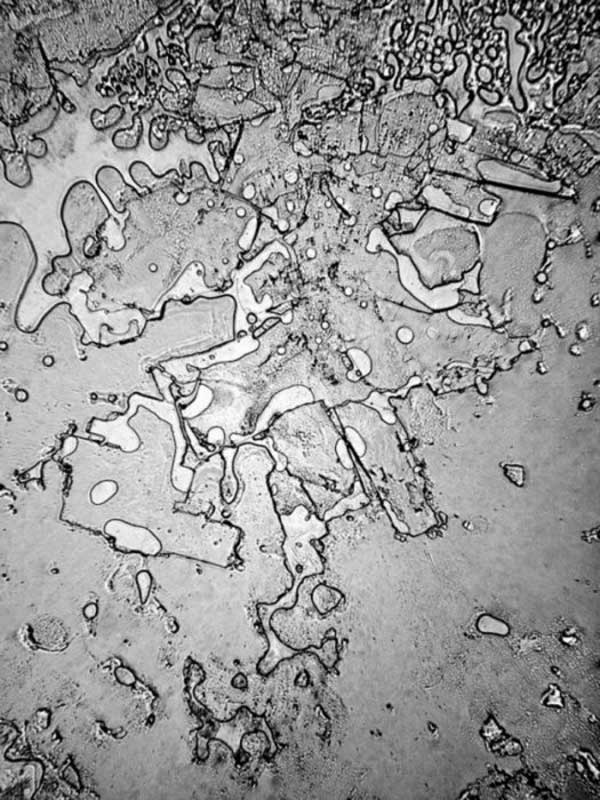 Человеческая слеза под электронным микроскопом